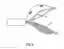 Fig. 10 - Medical device to remove an obstruction from a body lumen, vessel or organ
