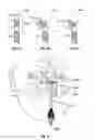 Fig. 05 - Deflectable guide catheters and related methods