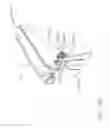 Fig. 90 - Surgical instrument comprising a plurality of drive systems