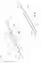 Fig. 07 - Dual access incising catheter