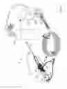 Fig. 02 - Atherectomy system