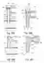 Fig. 21 - Cannula for use in intraosseous injections