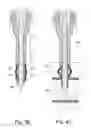 Fig. 22 - Cannula for use in intraosseous injections