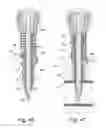 Fig. 25 - Cannula for use in intraosseous injections