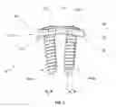 Fig. 04 - Bone plate system