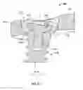 Fig. 21 - Bone plate system