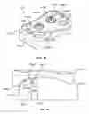 Fig. 26 - Bone plate system