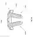Fig. 36 - Bone plate system