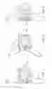 Fig. 08 - Interspinous spacer