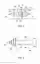 Fig. 02 - Self-compressing implant