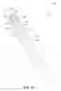 Fig. 13 - EXPANDABLE ORTHOPEDIC IMPLANT