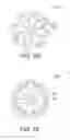 Fig. 16 - EXPANDABLE ORTHOPEDIC IMPLANT