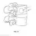 Fig. 08 - Scoop cannula with deflectable wings