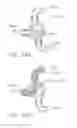Fig. 22 - Surgical evacuation sensing and motor control