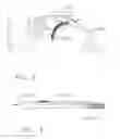 Fig. 03 - Surgical evacuation sensor arrangements