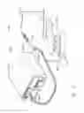 Fig. 07 - Surgical evacuation sensing and generator control