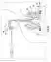 Fig. 22 - Methods, apparatuses, and systems for the treatment of pulmonary disorders