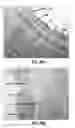 Fig. 44 - Methods, apparatuses, and systems for the treatment of pulmonary disorders