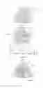 Fig. 04 - Control data generation for the eye surgical treatment of defective vision