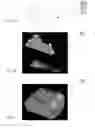 Fig. 02 - IDENTIFICATION AND TRACKING OF A PREDEFINED OBJECT IN A SET OF IMAGES FROM A MEDICAL IMAGE SCANNER DURING A SURGICAL PROCEDURE