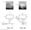 Fig. 02 - Apparatus and method for detecting an interventional tool
