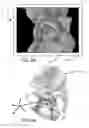 Fig. 12 - Systems and methods for intra-operative pelvic registration