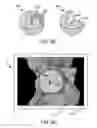 Fig. 13 - Systems and methods for intra-operative pelvic registration