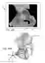 Fig. 15 - Systems and methods for intra-operative pelvic registration