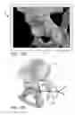 Fig. 16 - Systems and methods for intra-operative pelvic registration
