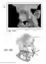 Fig. 17 - Systems and methods for intra-operative pelvic registration