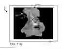 Fig. 19 - Systems and methods for intra-operative pelvic registration