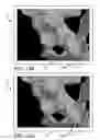 Fig. 23 - Systems and methods for intra-operative pelvic registration