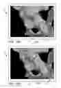 Fig. 24 - Systems and methods for intra-operative pelvic registration