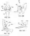Fig. 26 - Systems and methods for intra-operative pelvic registration