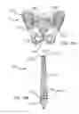 Fig. 27 - Systems and methods for intra-operative pelvic registration