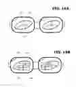 Fig. 11 - Head-worn image display apparatus for stereoscopic microsurgery
