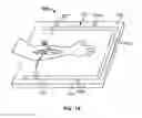 Fig. 02 - Device for surgical assistance