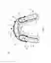 Fig. 02 - Orthodontic space closure device