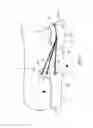 Fig. 03 - Orthodontic space closure device