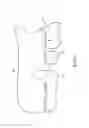 Fig. 04 - Orthodontic space closure device