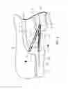 Fig. 06 - Orthodontic space closure device