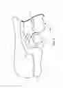 Fig. 07 - Orthodontic space closure device