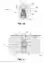 Fig. 08 - Dental tools system and method
