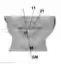 Fig. 01 - Method for determining and drawing the ideal individual shape of the upper front teeth