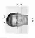 Fig. 02 - Method for determining and drawing the ideal individual shape of the upper front teeth