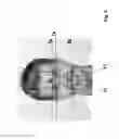 Fig. 04 - Method for determining and drawing the ideal individual shape of the upper front teeth
