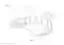 Fig. 02 - Positioning handle and occlusal locks for removable prosthesis