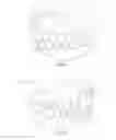 Fig. 03 - Positioning handle and occlusal locks for removable prosthesis