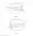 Fig. 06 - Positioning handle and occlusal locks for removable prosthesis