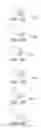 Fig. 16 - Dental implantation system